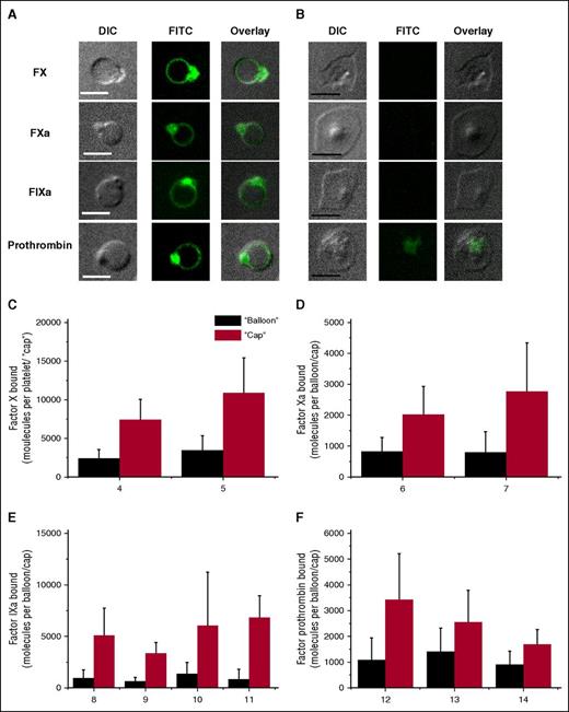 Figure 2. Characteristics of FX, FXa, FIXa, and prothrombin distribution on the surface of procoagulant-activated platelets. Platelets (5 × 104 μL−1) were activated with 100 nM thrombin plus 20 μg/mL CRP, incubated for 5 minutes with either 250 nM FX, 30 nM FХa, 60 nM FIXa, or 60 nM prothrombin, and imaged with confocal microscopy. (A-B) Representative confocal images of DIC, FITC (green) fluorescence of FX, FXa, FIXa, and prothrombin, and overlay are shown for procoagulant platelets (A) and nonprocoagulant ones (B). Scale bars, 5 μm. (C-F) The quantities of factor molecules bound to the “cap” (red bar) and to the “balloon” (black bar) are shown. Mean ± SD in (C-F) were determined for 30 to 70 procoagulant platelets analyzed in each experiment.
