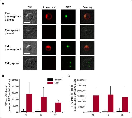Figure 3. Characteristics of FVa and FVIII distribution on the surface of activated platelets. Platelets (5 × 104 μL−1) were activated with 100 nM thrombin plus 20 μg/mL CRP (for FVa; we did not add thrombin in case of FVIII), incubated for 5 minutes with specific antibodies to detect FV/FVa and imaged with confocal microscopy. (A) Representative confocal images of DIC, and FITC (green) fluorescence of FV/FVa and FVIII/FVIIIa, and overlay are shown. Scale bars, 5 μm. (B-C) Integral fluorescence for the bound factors. Mean ± SD in (B-C) were determined for 30 to 70 procoagulant platelets analyzed in each experiment.