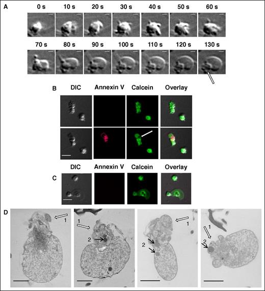 Figure 5. Dynamics and inner structure of the “caps.” (A) Formation of the “balloon” and of the “cap” (indicated with arrow) in the procoagulant platelet at indicated times after activation. See also supplemental Video 2. Scale bars, 1 μm. (B) Distribution of calcein in procoagulant platelets at 5 minutes after the stimulation (upper row) and after the procoagulant platelet formation (at 20 minutes after the stimulation) (lower row). (C) The same for the nonprocoagulant platelets. (D) Transmission electron microscopic images of PS-positive platelets and of the “caps” indicated with white arrows (numbered 1). Discernible mitochondria are indicated with black arrows (numbered 2). Scale bars, 1 μm.