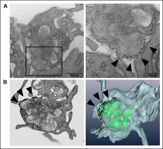 Figure 6. Immunogold Annexin V–labeling and FIB-SEM imaging of the PS-positive platelets, and of the “caps.” (A) Immunoelectron microscopy of Annexin V binding to platelets; the left panel shows increased magnification. (B) FIB-SEM imaging (left) and 3D-reconstruction (right) of the procoagulant platelets. The arrows indicate Annexin V on the platelet “cap.”