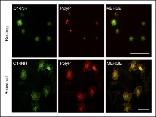 Figure 6. PolyP and C1-INH colocalize in activated human platelets. Human platelets were plated onto glass coverslips in the resting state (top panels) or after 2 minutes of activation with 100 nM of the phorbol ester, phorbol 12-myristate 13-acetate, and 1 μM of calcium ionophore A23187. After fixation and permeabilization, the platelets were stained as described in “Materials and methods” to detect C1-INH (left panels, green) and polyP (middle panels, red) by confocal microscopy. The right panels reveal the merged images. In resting platelets, C1-INH is detected in α granules and on the cell surface, and polyP is found in dense granules. After activation, C1-INH and polyP coalesce in the center of the platelets where they colocalize (yellow, right bottom panel). Size bars, 10 μm. Results are representative of 3 independent experiments.