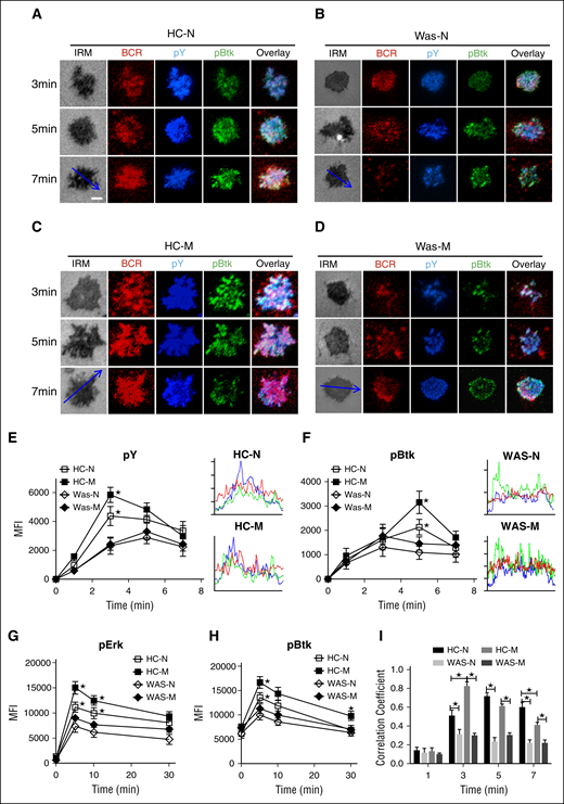 The recruitment of pY and pBtk were reduced in WAS memory B cells. (A-D) TIRFM and IRM analysis of pY and pBtk staining in the contact zone of HCs and WAS (P1-12) naive and memory B cells incubated with membrane-tethered Fab′–anti-Ig. Shown are representative images (A-D) and the MFI (±SD) of pY (E) and pBtk (F) in the B-cell contact zone from 3 independent experiments. Bars, 2.5 µm. *P < .01, compared with WAS naive B cells. Enriched B cells from HCs or WAS (P5-15) PBMCs were incubated with soluble antigens for varying lengths of time, fixed, permeabilized, and then stained with antiphosphorylated Erk (G) and Btk (H) antibody. The colocalization coefficients between BCR and pY and pBtk staining were determined using NIS-Elements AR 3.2 software. Shown are the colocalization coefficients (±SD) (I) from ∼50 individual cells of 3 independent experiments. Bars, 2.5 µm. *P < .01, compared with WAS naive or memory B cells.