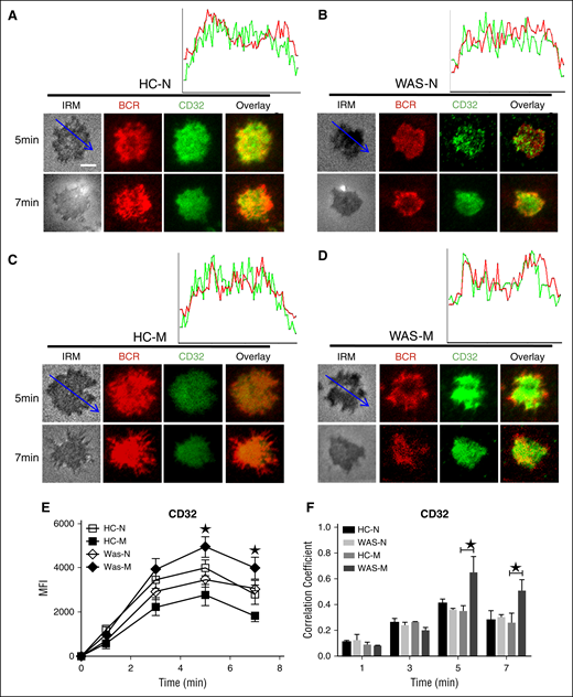 The recruitment of FcγRIIB was increased in WAS memory. (A-D) TIRFM and IRM analysis of FcγRIIB staining in the contact zone of HCs and WAS patient (P1-12) memory and naive B cells incubated with membrane-tethered Fab′–anti-Ig. The colocalization coefficients between BCR and FcγRIIB staining were determined using NIS-Elements AR 3.2 software (F). Shown are representative images (A-D) and the average MFI (E) or colocalization coefficients (F) (±SD) from ∼300 individual cells of 3 independent experiments. Bars, 2.5 µm. *P < .01, compared with WAS naive or memory B cells.