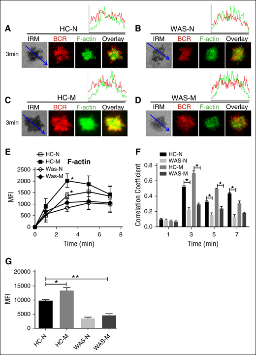 F-actin recruitment was increased in HCs memory B cells. (A-D) TIRFM and IRM analysis of phalloidin staining in the contact zone of HCs and WAS (P1-12) naive and memory B cells incubated with membrane-tethered Fab′–anti-Ig. TIRFM analysis of the spatial relationship of BCR with F-actin (A-D) in the contact zone of splenic B cells incubated with membrane-tethered Fab′–anti-Ig. The colocalization coefficients between BCR and F-actin staining were determined using NIS-Elements AR 3.2 software (F). The quantification of MFI of the basal level of F-actin in naive or memory B cells from HCs or WAS (P1-12) patients by flow cytometry (G). Shown are representative images (A-D), and the average MFI (E) or colocalization coefficients (F) (±SD) from ∼50 individual cells of 3 independent experiments. Bars, 2.5 µm. *P < .01, compared with WAS naive or memory B cells.