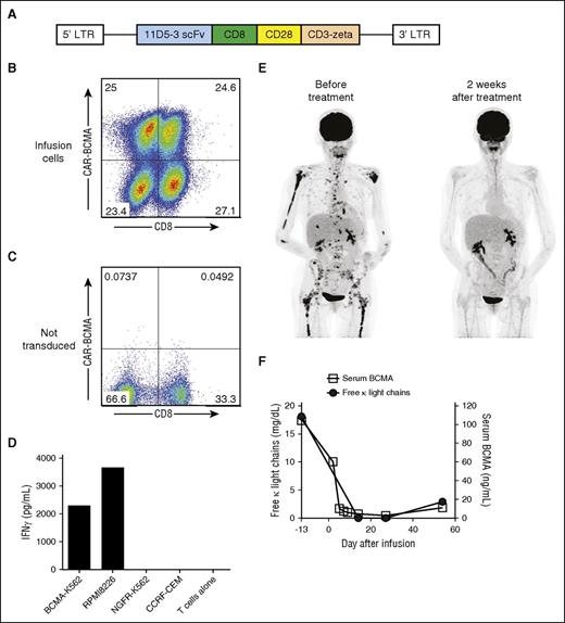 Figure 1. CAR-BCMA T cells specifically recognized BCMA in vitro and exhibited antimyeloma activity in humans. (A) Diagram of the MSGV-11D5-3-CD828Z γ-retroviral vector encoding the anti-BCMA CAR (CAR-BCMA) is shown. CAR-BCMA contained the 11D5-3 anti-BCMA single chain variable fragment (scFv), CD8α hinge and transmembrane regions, the cytoplasmic portion of the CD28 costimulatory moiety, and the CD3ζ T-cell activation domain. (B) CAR-BCMA expression on the surface of the infusion T cells of patient 10 was detected by staining with a PE-BCMA-Fc protein reagent. The plot is gated on live CD3+ lymphocytes. (C) Demonstrating specificity, the PE-BCMA-Fc reagent did not stain PBMCs that were not transduced with the CAR-BCMA gene. (D) CAR-BCMA T cells of patient 10 were cultured with target cells that either expressed BCMA (BCMA-K562 and RPMI8226) or did not express BCMA (NGFR-K562 and CCRF-CEM). The CAR-BCMA T cells of patient 10 specifically released IFNγ in response to BCMA-expressing target cells in vitro. (E) Patient 8 who had MM that was progressing despite 8 prior lines of therapy obtained a very good partial remission (VGPR) after infusion of CAR-BCMA T cells. Positron emission tomography–computed tomography scans from before and after treatment show elimination of a large number of MM bone lesions. (F) Patient 8’s free κ light chains level decreased after CAR T-cell infusion as the MM entered a VGPR and then increased with progression of the MM. The serum BCMA protein level followed a pattern similar to that of the serum free κ light chains.