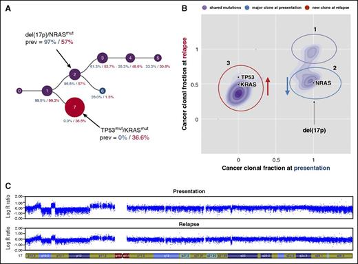 Figure 3. Independent events involving the TP53 locus. Copy number profiles and mutation data were derived from high-resolution copy number arrays and whole-exome sequencing data, respectively. The clonal evolution in one patient from presentation to relapse as predicted by PhyloWGS19 and as further interpreted after inclusion of copy number data are shown in (A). The cancer clonal fractions of mutations detected in this patient are presented in (B). Mutations were manually assigned to clusters/subclones. In both plots, blue denotes aberrations/clones detectable only at presentation, red indicates aberrations/clones found only at relapse, and aberrations/clones present at both time points are shown in purple. Mutations in (B) that were not assigned to a cluster are depicted in gray. The LogR ratio for chromosome 17 at presentation and relapse is shown in (C). The major clone at presentation contained a NRAS mutation and a deletion at 17p involving the TP53 locus. This clone declined, whereas a new clone appeared with a KRAS and a TP53 mutation at relapse.