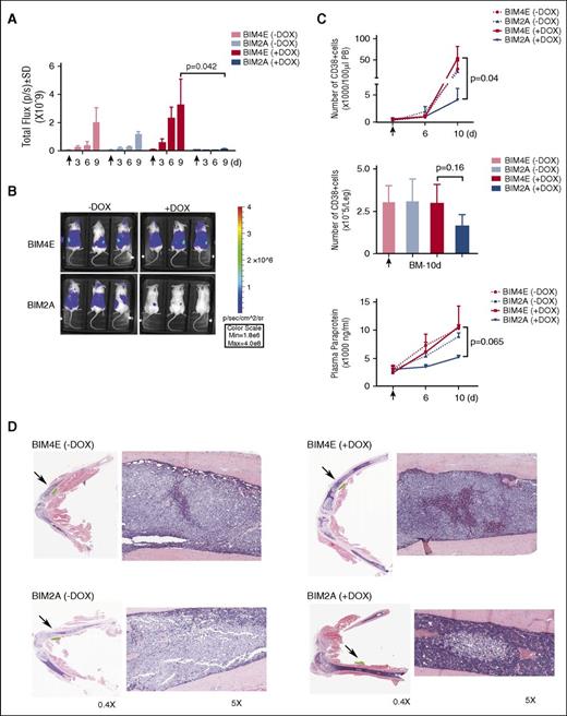 Figure 6. Inhibiting MCL1 suppresses the growth of the myeloma cell line AMO1 in vivo. (A) Expression of the MCL1-selective ligand BIM2A slows the growth of AMO1 myeloma cells in vivo. Here, 5 × 106 AMO1 cells engineered to coexpress the luciferase gene and the BIM variants were injected intravenously into female NSG mice. Ten days after tumor inoculation (indicated by an arrow, ↑), the mice were divided into those fed with DOX-containing (+: to induce expression of the BIM variant) or normal (−) food, and the mice then were imaged every 3 days afterward on days 3, 6, and 9. Compared with the mice expressing BIM4E or the control mice fed with normal food, significant suppression of tumor growth was observed in mice expressing BIM2A. The results are representative of 2 independent experiments (n = 3 mice in each group). The average luciferase activity was calculated from the dorsal, lateral, and ventral views of the mice. Detailed results are shown in supplemental Figure 18. (B) Representative of images of the mice described in A 9 days after commencing DOX treatment. (C) Expression of BIM2A slows disease progression in vivo. The infiltration of myeloma cells (CD38+) in the peripheral blood (upper), bone marrow (middle), or serum paraprotein (IgAκ) levels (bottom) were determined 0 to 10 days after the mice were commenced on treatment with DOX (n = 3 mice in each group). Note the delayed disease progression when expression of BIM2A was induced. (D) BIM2A ameliorates the infiltration of AMO1 myeloma cells into the bone marrow. Representative histological images (H&E staining; ×0.4 or ×5 magnification) for detection of bone marrow infiltration with myeloma cells (pale areas) taken from the legs of representative mice. The regions marked with an arrow (left) were enlarged for higher magnification (right; ×5 instead of ×0.4).