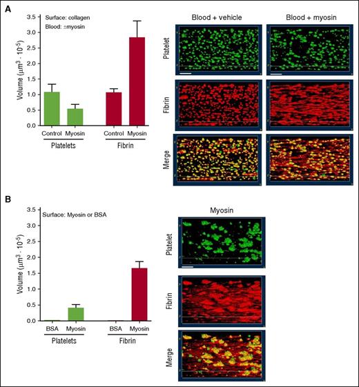 Figure 1. Myosin is thrombogenic in ex vivo studies of fresh human blood under flow. The thrombogenicity of myosin was studied either (A) when myosin (or control vehicle) was added to whole blood that then flowed over collagen-coated surfaces or (B) when whole blood without myosin addition flowed over myosin-coated surfaces. Data represent observations at 4 minutes after flow initiation at 300 s−1 wall shear rate. (A) Either skeletal muscle myosin (50 µg/ml) or control buffer vehicle was added to recalcified blood before its perfusion over a collagen-coated surface. Three-dimensional reconstruction of platelet aggregates and fibrin on a collagen-coated coverslip was generated from confocal z-sections serially collected after blood perfusion. Recalcified flowing human blood contained mepacrine (green) to visualize platelets and Alexa Fluor 546–labeled anti–fibrin antibody (red) to visualize fibrin. Yellow represents superposition of corresponding images at 4 minutes. White bars shown in the top panels indicate 20 μm. The amounts of fibrin and platelet deposition are shown in the bar graphs (average values from 2 experiments). (B) Recalcified human blood was perfused over immobilized myosin at 300 s−1 shear rate. Three-dimensional reconstruction of platelet aggregates and fibrin on myosin or BSA coated coverslip was generated as described for panel A. Images of deposited platelets and fibrin formation after maintaining blood perfusion for 4 minutes are shown. The volumes of fibrin and platelet deposition are shown in the bar graphs (average values from 3 experiments). Human blood perfused over immobilized BSA at 300 s−1 shear rate for 4 minutes did not form detectable platelet aggregates or fibrin (data not shown).