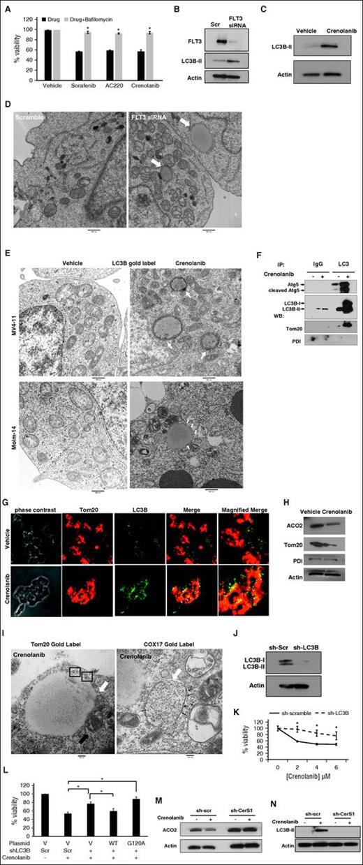 Figure 2. Inhibition of FLT3 induces mitophagy. (A) MV4-11 cells are pretreated with bafilomycin, inhibitor of autophagy, followed by treatment with 10 μM sorafenib, 10 μM AC220, or 5 μM crenolanib for 24 hours. Cell viability is measured using the MTT assay. (B) Western blot to detect LC3B-I (top band) and LC3B-II (bottom band) in MV4-11 cells transfected with FLT3 siRNA. (C) Western blot measuring LC3B in cells treated with crenolanib FLT3 inhibitor. (D) MV4-11 cells were transfected with FLT3 siRNA and visualized for morphology. White arrows indicate autophagosomes. (E) MV4-11 or Molm-14 cells were treated with crenolanib and gold labeled with LC3B. White arrows indicate LC3B immune-gold label in autophagosomal structures. (F) Disrupted cells were incubated with agarose beads and LC3B antibody to pull down autophagosomes followed by western blotting for Atg5, LC3B, and Tom20 in purified autophagosomes. (G) Confocal microscopy for treated cells dual labeled with LC3B antibody and Tom20 mitochondrial marker. (H) Western blotting measuring ACO2, Tom20, and PDI in crenolanib-treated cells. (I) Electron microscopy visualization of autophagosomes in crenolanib-treated cells gold labeled with Tom20 or COX-17. Squares or small black arrows indicate gold label. White arrow indicates autophagosomes. (J) Western blot analysis for LC3B in sh-scr and sh-LC3B stable-transfected cells. (K) Percentage of viability measured using the MTT assay in sh-LC3B cells treated with different doses of crenolanib for 24 hours. (L) Percentage of nonviable cells measured using MTT assay in sh-scr, sh-LC3B, sh-LC3B+WTLC3B, and sh-LC3B+LC3BG120A. (M-N) Western blot to measure ACO2 and LC3B-II in crenolanib-treated sh-scr vs sh-CerS1 cells. *P value of <.05 using the 2-sided Student t test. All images are representative of at least 2 independent experiments.