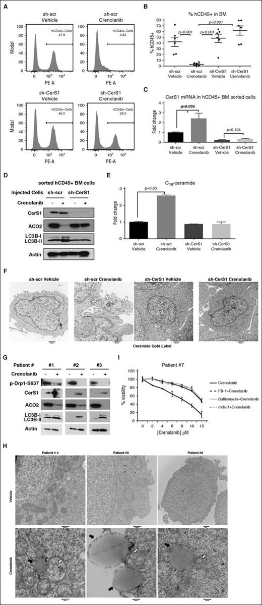 Figure 6. CerS1-C18-ceramide–mediated lethal mitophagy is required for FLT3-targeted therapy in the AML mouse model and human AML blasts. (A-B) FACS analysis to measure the percentage of injected AML cells (hCD45+ cells) in the bone marrow. Values indicate mean ± SD of n = 6 mice. P values were generated using ANOVA. (C) qPCR to measure CerS1 mRNA in sorted hCD45+ cells. (D) Western blot to measure CerS1, ACO2, and LC3B in sorted hCD45+ cells. (E) HPLC-MS-MS measuring C18-ceramide in sorted hCD45+ cells. Values indicate mean ± SD of n = 3 mice. P values were generated using the Student t test. (F) EM visualization of sorted hCD45+ cells from bone marrow of NSG mice with AML xenografts. (G) CD34+ bone marrow blasts obtained from FLT3-ITD+ patients were treated with 5 μM crenolanib for 24 hours, followed by western blot to detect p-Drp1 S637, CerS1, ACO2, and LC3B. (H) EM visualization of crenolanib-treated FLT3+ AML patient blasts labeled with ceramide antibody. White arrows indicate ceramide gold label in mitochondria and black arrows indicate autophagosomes. (I) Percentage of viability of AML patient blasts pretreated with either FB-1, bafilomycin, or mdivi1, followed by 5 μM crenolanib treatment of 24 hours. *P value of <.05 using the 2-sided Student t test.