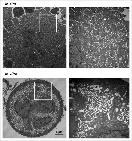 Figure 1. Different ultrastructures of mature MKs differentiated in situ or in vitro. Electron microscopy images of WT murine MKs differentiated in the BM (in situ, upper panel) or in liquid culture in vitro (lower panel). The images of whole cells (left) and close-up views (right) are representative of at least 4 different mouse BM samples (in situ) and 10 different liquid cultures.