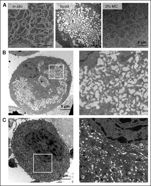 Figure 4. DMS morphology depends on the stiffness of the medium. (A) Electron microscopy images of stage III BM MKs (in situ) or MKs differentiated for 3 days in liquid or 2% MC cultures (class 3). Scale bar = 2 µm. Images are representative of at least 4 mice (in situ) or 10 cultures. (B) Left, electron microscopy image of an MK differentiated for 3 days in 2% MC and resuspended in a liquid medium for 2 hours before fixation (representative of 3 independent experiments with >90 MKs examined). Right, close-up view of the cytoplasm of the MK. (C) Left, electron microscopy image of an MK from BM after dissociation and resuspension for 2 hours in a liquid medium (representative of 3 independent experiments with >90 MKs examined). Right, close-up view of the cytoplasm of the MK.