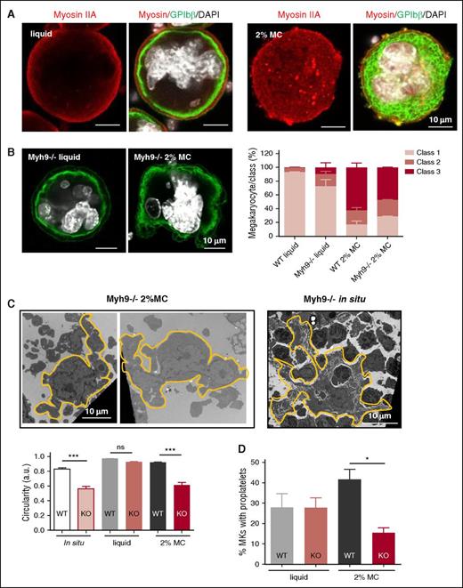 Figure 6. Differential involvement of myosin IIA in MC-mediated MK culture. (A) Myosin IIA immunolabeling (red) along with GPIbβ-positive membranes (green) and nucleus (DAPI, white). (B) Left, confocal microscopy images of Myh9−/− MKs in liquid or 2% MC cultures. Right, bar graphs represent the proportions of Myh9−/− cells in the different MK classes in liquid and 2% MC cultures, as compared with WT cells. Results are expressed as the mean ± SEM and are from 3 independent experiments, with a total of 86-93 MKs examined per condition. (C) Upper panel, electron microscopy images of Myh9−/− MKs in 2% MC cultures (left), as compared with in situ MKs (right). Images are representative of at least 6 different cultures and 4 different Myh9−/− BMs. Lower panel, bar graphs of the circularity of WT and Myh9−/− MKs in situ and in liquid and 2% MC media. Results are the mean ± SEM in 3 independent experiments, with a total of 37-59 cells examined per condition. ***P < .0001 using an ANOVA analysis and a Newman-Keuls posttest; ns, not significant. (D) Bar graphs represent the percentages of MKs bearing proplatelets in Myh9−/− liquid and 2% MC cultures, as compared with WT cells. Results are the mean ± SEM in 3 independent experiments, with a total of 428-557 MKs examined per condition. *P < .05 using an ANOVA analysis and a Newman-Keuls posttest. KO, Myh9 knockout.