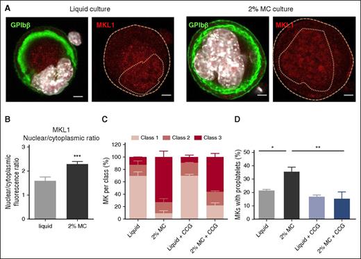 Figure 7. Proplatelet formation is promoted by nuclear accumulation of MKL1. (A) Confocal microscopy images of WT MKs after 3 days of culture in a liquid or 2% MC medium. The DMS and plasma membrane are visualized in green by immunolabeling with anti-GPIbβ; MKL1 immunolabeling is depicted in red, and nuclei appear in white (DAPI staining). The dotted lines delineate cell and nuclear margins. Images are representative of 3 independent experiments. (B) Bar graphs represent the MKL1 fluorescence in the cytoplasm and nucleus and the nuclear/cytoplasmic ratio, in MKs in liquid and 2% MC cultures. Results are the mean ± SEM in 3 cultures, with a total of 189-192 cells analyzed per condition. ***P < .0001 using Student t test. (C, D) Class distribution and proplatelet formation in MKs grown in a liquid or 2% MC medium, in the presence or absence of 10 µM CCG-1423. Results are the mean ± SEM in 3 independent cultures, with a total of 90-94 cells examined per condition (C), or in 4 independent cultures, with a total of 510-800 cells examined per condition (D). *P < .05, **P < .01 using ANOVA analysis and a Newman-Keuls posttest.