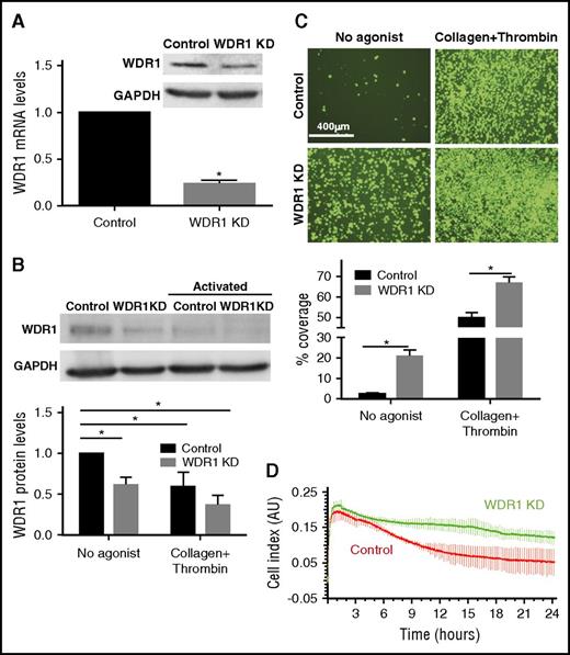 Figure 3. WDR1 knockdown in MEG-01 cells affects cell size, adhesion, and spreading. MEG-01 cells were transfected with scrambled shRNA (control) or WDR1 shRNA (WDR1 KD). (A) WDR1 mRNA and protein expression in WDR1 KD and control MEG-01 cells. Data are mean ± SEM for 3 independent experiments. (B) WDR1 protein expression in WDR1 KD and control MEG-01, in the absence of agonist with noncoated glass coverslips or stimulated for 12 hours with thrombin 1 U/mL and adherent on collagen-coated coverslips and quantification. Data are mean ± SEM for 3 independent experiments (P = .004, .005, and .002 respectively, Student t test). (C) Adhesion of WDR1 KD and control MEG-01 cells (green) in the absence and presence of thrombin 1 U/mL on collagen-coated coverslips and adhesion quantification (P < .0001 and P = .0002, respectively, Student t test) Data are mean ± SEM for 3 independent experiments. (D) Assay for adhesion and spreading of WDR1 KD and control MEG-01 cells following stimulation with thrombin 1 U/mL and collagen 5 µg/mL using the xCELLigence system. The xCELLigence system measured impedance every 4 minutes for 24 hours, reported as a cell index value. Lines and bars = mean ± SEM of quadruplicates. Similar results were obtained in an additional 2 experiments. *P < .05 vs unstimulated control MEG-01 cells. AU, arbitrary unit.