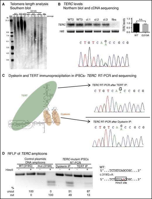 Figure 2. The TERC G319A mutation impairs TERC:TERT interaction. (A) Telomere restriction fragment length (TRF) analysis of normal (WT) iPSCs, 3 independent TERC-mutant iPSC clones (cl), and TERC-mutant fibroblasts. (B) Top left, Representative Northern blot of TERC RNA from WT, TERC-mutant iPSCs, and TERC-mutant fibroblasts. Top right, Relative TERC levels are shown in the graph. Bottom, Sequencing of TERC cDNA from TERC-mutant iPSCs. (C) Left, Schematic of TERC RNA in complex with TERT and dyskerin. Right, Sequencing of TERC RT-PCR amplicons isolated from TERT RNP (top) and dyskerin RNP (bottom) isolated by immunoprecipitation (IP) from TERC-mutant iPSCs. (D) Restriction fragment length polymorphism (RFLP) of TERC amplicons from dyskerin or TERT IP of patient iPSCs (lanes 5-8). The HincII site created by the G319A mutation is depicted on the right. Lanes 1-4 show digest patterns of amplicons from WT (319G) and mutant (319A) plasmid DNA. Products were separated by agarose gel electrophoresis and band intensity was quantified using ImageLab. n.s., not significant.