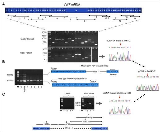 Figure 1. RT-PCR products on agarose gel. (A) Schematic scale of the coding region of VWF (exons 2-52) with the primer positions designed for amplification of the full-length VWF mRNA and corresponding amplicon segments. Agarose gel electrophoresis image shows the 14 overlapping RT-PCR products of VWF using total RNA from the IP’s blood as template, under thermocycling conditions with 2 minutes of extension time. The sequence chromatogram of segments 12 and 13 (both covering exon 44 carrying the silent mutation c.7464C>T) demonstrate single-peak manifestation of wt nucleotide C, c.7464C, indicating a fail in amplification of the mutant transcript. Lanes 13 and 14 were run in a separate gel but with similar running conditions. (B) RT-PCR products of segment 12 amplified with primers residing in exon 39 and exons 45/46 boundary, and with increased extension time (6 minutes) of thermocycling. RT-PCR products of RNA obtained from blood of the IP and her mother demonstrate a smaller product (920 bp) relevant to the normal transcript and an aberrant larger fragment (3130 bp) corresponding to the retained intron 44 in mRNA, whereas RT-PCRs using RNA from 5 healthy control subjects as template show only the smaller normal fragment (lanes 1-5). (C) RT-PCR amplification using allele-specific primers to confirm intron 44 retention. The primer combinations and expected amplicon sizes, if intron 44 is retained, are as follows: segment 1 (1437 bp), forward primer in exons 40/41 boundary and reverse primer targeted in intron 44, 861 nucleotides downstream of the exon 44 (lane 1); and segments 2, 3 and 4 (length 1873, 1683, and 896 bp, respectively), forward primers directed in intron 44 in 3 different positions (+787, +977, and +1764) and reverse primer in exons 48/49 boundary (lanes 2, 3, and 4). Sequence analysis of the cDNA segment 1 exhibited monoallelic presentation of the mutant variant T (c.7464T) in the sequence chromatogram, indicating that the aberrant transcript is derived solely from the mutant allele. Lane M represents the molecular weight marker (1-kb ladder).