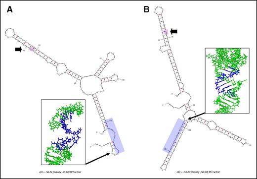Figure 4. Secondary structure prediction of pre-mRNA sequence. Secondary structure of the wt pre-mRNA sequence (A) and the mutated pre-mRNA sequence (B) predicted by mfold. Many of the 5′ donor splice site residues (5 residues: −1U, +1G, +2U, +3A, and +7C) that bind to U1 snRNA were observed to be free in the wt sequence but prebound or physically constrained in a double-stranded form in the mutated sequence. The regions corresponding to residues that bind to U1 snRNA are marked by the lavender-shaded area. The mutated residue locations are also marked by the magenta-shaded area and identified by a thick arrow. The inset images in each panel correspond to a close-up view of the region of pre-mRNA that binds to U1 snRNA in the 3-dimensional model of the wt and mutated structures generated from mfold secondary structure prediction on the RNAComposer Web server. The model structure is depicted in stick format (light green). The residues that bind to U1 snRNA are shown in blue. Hydrogen bonds are depicted as magenta dots.