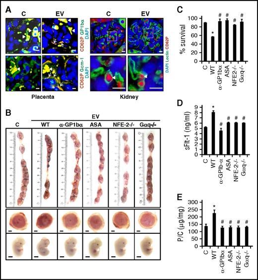 Figure 2. Maternal platelets mediate EV-induced PE-like phenotype in mice. (A) Double immunofluorescence staining showing activated platelets (CD62P, P-selectin; red) in the placenta (left), but not in the kidney (right), after injections of mouse endothelial cell–derived EVs. CD62P (red) colocalizes (yellow) with GP1bα (green) indicating presence of activated platelets within the placenta (Placenta, top left panel). Colocalization (yellow) of activated platelets (CD62P; red) and Gcm-1+ syncytiotrophoblast (arrows, green) indicates direct contact of activated platelets with syncytiotrophoblasts, which line maternal blood spaces within the placenta (Placenta, bottom left panel); conventional immunofluorescence analyses; arrowheads, autofluorescence of erythrocytes. (B-C) Depletion of maternal platelets using anti-GP1bα antibody, inhibition of maternal platelets using aspirin, genetic platelet deficiency (p45 NF-E2−/− mice), or genetically superimposed diminished platelet activation (Gαq deficiency) protects pregnant female mice from EV-induced impaired pregnancy outcome. Pregnancy outcome at day 12.5 p.c. after EV injection (mouse endothelial cell–derived EVs) at days 10.5 p.c. and 11.5 p.c. into pregnant females mated to WT males. (B) Representative images of uterus (top), placentae (middle), and embryos (bottom) along with (C) bar graphs quantifying embryonic survival. (D-E) Plasma sFlt-1 levels (D) and proteinuria (E, bar graph summarizing data of P/C ratio) are normal despite EV treatment in platelet-depleted, aspirin-treated, NFE-2−/−, or Gαq−/− pregnant female mice. Scale bar represents (A) 80 µm for placenta and 10 µm for kidney, and (B) 1 mm for embryo and placenta. Data represent mean ± SEM of at least 8 placentae or embryos analyzed from at least 3 different litters of each group. Control mice (C) were injected with the supernatant obtained after the last PBS wash during EV isolation. *P < .05 (relative to control, C); #P < .05 (relative to EV). (C-E) ANOVA. ASA, acetylsalicylic acid; DAPI, 4′,6-diamidino-2-phenylindole.
