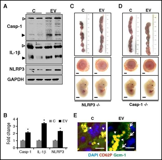 Figure 3. EVs cause inflammasome activation in placenta. (A-B) Inflammasome activation in murine placentae after EV injections (mouse endothelial cell–derived EVs). Immunoblots showing increased cleaved Casp-1 and cleaved IL-1β and increased NLRP3 expression in murine placentae after EV injections, analyzed at day 12.5 p.c. (A, representative immunoblots; B, bar graph summarizing results). Arrowheads indicate inactive (proform, white arrowheads) and the active (cleaved form, black arrowheads) form of Casp-1 or IL-1β, respectively (A). Only the active form was quantified (B). (C-D) Representative images of (top) uterus, (middle) placentae, and (bottom) embryos showing protection from mouse endothelial-derived EV-induced pregnancy complications in NLRP3−/− (C) and Casp-1−/− (D, Casp-1) mice. Size bar, 1 mm. (E) Double immunofluorescence staining showing activated platelets (CD62P, P-selectin; red) in the placenta after EV injection in pregnant NLRP3−/− females mated with NLRP3−/− males. Activated platelets are in direct contact with syncytiotrophoblast (Gcm-1; green); yellow indicates colocalization of activated platelets and Gcm-1+ syncytiotrophoblast (arrows); conventional immunofluorescence analyses; arrowheads, autofluorescence of erythrocytes. Scale bar, 20 µm. Control mice (C) were injected with the supernatant obtained after the last PBS wash during EV isolation. Data shown represent mean ± SEM of at least 8 placentae or embryos analyzed from at least 3 different litters of each group *P < .05 (relative to control, C). (B) Student t test. GAPDH, glyceraldehyde 3-phosphate dehydrogenase.