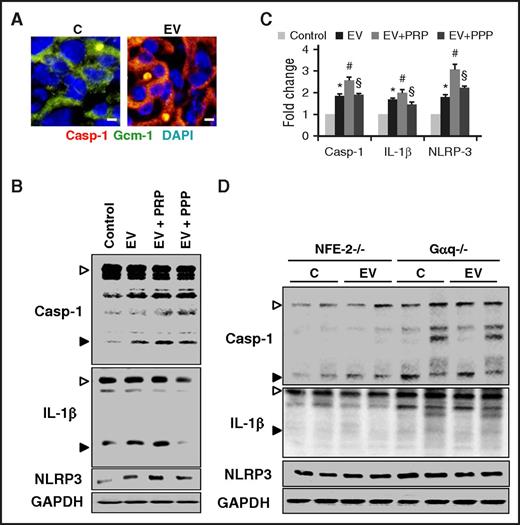 Figure 4. EVs cause platelet-dependent inflammasome activation in trophoblast cells. (A) Representative images (double immunofluorescence staining) showing colocalization (yellow) of cleaved Casp-1 (red) and Gcm1 (green, syncytiotrophoblast marker) indicating inflammasome activation in trophoblasts after EV injections. Size bar represents 80 µm. (B-C) Platelets enhance EV-mediated (mouse endothelial cell–derived EVs) inflammasome activation in murine trophoblast cells. Representative immunoblots showing enhanced EV-mediated inflammasome activation in trophoblast cells in the presence of PRP (EV+PRP) compared with EVs only (EV) or EVs with PPP (EV+PPP). Control cells were exposed to the supernatant obtained after the last PBS wash during EV isolation (B, representative immunoblots; C, bar graph summarizing results). (D) Immunoblots showing no effect on inflammasome activation in p45-NF-E2+/− and Gαq+/− placenta after EV treatment in p45-NF-E2−/− or Gαq−/− pregnant female mice, respectively (representative immunoblots). Arrowheads indicate inactive (proform, white arrowheads) and the active (cleaved form, black arrowheads) form of Casp-1 or IL-1β, respectively (B,D). Only the active form was quantified (C). Data shown represent mean ± SEM from 5 independent experiments. *P < .05 (relative to control, C); #P < .05 (relative to EV); §P < .05 (relative to EV+PRP). (C) ANOVA.