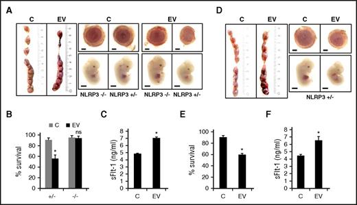 Figure 5. Placental inflammasome activation causes PE. (A-B) Pregnancy outcome at day 12.5 p.c. after IV. EV (mouse endothelial cell–derived) injection at days 10.5 p.c. and 11.5 p.c. into pregnant NLRP3+/− females mated to NLRP3−/− males. (A) Representative images of uterus (left panel), placenta (right top panel), and embryo (right bottom panel) and (B) bar graph quantifying embryonic survival. (C) Elevated sFlt-1 plasma levels in EV-treated NLRP3+/− pregnant female mice at day 12.5 p.c. following EV injection; bar graphs summarizing results. (D-E) Pregnancy outcome at day 12.5 p.c. after IV EV injection at days 10.5 p.c. and 11.5 p.c. in NLRP3−/− females mated to NLRP3+/+ males. (D) Representative images of uterus (left panel), placenta (right top panel), and embryos (right bottom panel) along with (E) bar graph quantifying embryonic survival. (F) Elevated sFlt-1 plasma levels in EV-injected pregnant mice following mating NLRP3−/− females with NLRP3+/+ males; bar graphs summarizing results. Size bar represents 1 mm for embryo and placenta (A,D). Data shown represent mean ± SEM from at least 8 embryos analyzed from 3 different litters or 5 pregnant females of each group; control mice (C) were injected with the supernatant obtained after the last PBS wash during EV isolation. *P < .05 (relative to control, C). (B) ANOVA; (C-F) Student t test.