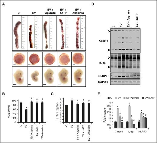 Figure 6. Inhibiting purinergic or inflammasome signaling protects from EV-induced PE. (A-B) Inflammasome inhibition using apyrase, oATP, or anakinra protects mice from EV-induced placental and fetal impairment. Representative images (A) showing uterus (top), placentae (middle), or embryos (bottom) obtained from control (C) or EV-injected (EV) pregnant mice without or with treatment (apyrase, oATP, or anakinra) and quantification of embryonic survival (B). Size bar represents 1 mm. (C) Injections with apyrase, oATP, or anakinra reduce plasma sFlt-1 levels in EV-injected pregnant mice; bar graph summarizing results. (D-E) Immunoblots showing reduced cleaved Casp-1 and IL-1β and NLRP3 expression indicating inhibition of EV-induced inflammasome activation in murine placentae after apyrase or oATP treatment (D, representative immunoblots; E, bar graph summarizing results). Arrowheads indicate inactive (proform, white arrowheads) and the active (cleaved form, black arrowheads) form of Casp-1 or IL-1β, respectively (D). Only the active form was quantified (E). Data shown represent at least 8 placentae or embryos analyzed from 3 different litters or 5 pregnant females of each group; control mice (C) were injected with the supernatant obtained after the last PBS wash during EV isolation. Mean ± SEM. *P < .05 (relative to C); #P < .05 (relative to EV). (E) ANOVA.