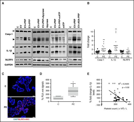 Figure 7. Inflammasome activation in human trophoblast cells and placenta. (A-E) Platelets enhance ATP-dependent EV-mediated (human umbilical vein endothelial cell–derived EVs) inflammasome activation in human trophoblast cells. (BeWo cells; A, representative immunoblots). EV-mediated inflammasome activation in BeWo cells is enhanced in the presence of PRP (EV+PRP) compared with EVs only (EV) or EVs with PPP (EV+PPP). EV-induced platelet-mediated inflammasome activation (EV+PRP) in BeWo cells is reduced using apyrase (EV+PRP+Apyrase), oATP (EV+PRP+oATP), or when using platelets from donors receiving aspirin (EV+ASA-PRP). (B-D) Inflammasome activation in human placentae obtained from women without pregnancy complications (controls; C) or with PE. Dot plot (B) showing increased cleavage of Casp-1 and IL-1β in PE vs controls, whereas NLRP3 expression does not change. Representative images (C) for proximity ligation assay (PLA) (D, box plot summarizing results) showing an increased frequency of NLRP3-ASC complexes in PE placentae compared with controls. (E) Graph showing an inverse correlation between platelet counts and cleaved IL-1β in human placentae obtained from women without pregnancy complications (controls; C; black) or with PE (gray). Arrowheads indicate inactive (proform, white arrowheads) and the active (cleaved-form, black arrow heads) form of Casp-1 or IL-1β, respectively (A). Only the active form was quantified (B). Size bar represent 20 µm (C). Data shown represent mean ± SEM. Data obtained from 5 independent experiments (A) or from 15 (B) or 5 (D) different placentae per group. *P < .05 (relative to control, C); #P < .05 (relative to EV); **P < .0005 (relative to control placentae, C). (B,D) Nonparametric Mann-Whitney U test; (E) Spearman correlation.