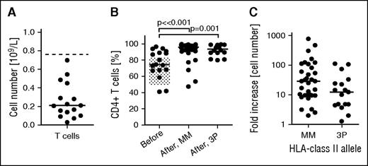 Figure 1. Characteristics of post-dUCBT patient PBMC samples before and after HLA class II allele-specific T-cell propagation. (A) Absolute numbers of CD3+ T cells in PB samples analyzed for HLA class II allele immune recognition. Graphs represent individual and median (line) values. Dotted line, lower limit of normal values of CD3+ T cells in blood of healthy individuals. (B) Percentage of CD4+ T cells in PB (before) and in T-cell cultures after HLA class II–specific amplification, with either HeLa cells transduced with HLA class II mismatched alleles (after, MM) or with HLA class II third-party alleles (after, 3P). Depending on the number of mismatched alleles in the dUCBT combination, from 1 to 7 T-cell amplification cultures per PB sample were performed. Graphs represent individual and median (line) observations. Gray area, normal range of CD3+CD4+ values in blood of healthy individuals; significance in nonpaired t tests is shown. (C) Increase in T-cell numbers in post-dUCBT PBMC samples following processing in HLA class II–specific amplification cultures, expressed as fold increase relative to the T-cell number at start of culture (see B).