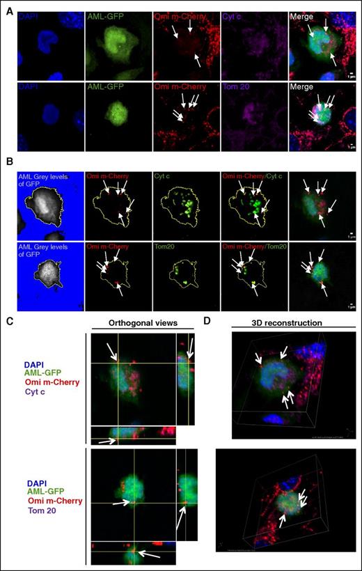 Figure 2. Functional mitochondria enter into AML cells. Confocal microscopy images of MS-5-Omi-mCherry cells cocultured with U937-GFP cells. Recorded fluorescence is indicated in the top left angle. (A) Representative cells are shown in Z-stack overlay mode. Mitochondria were evidenced using either anti-cytochrome C or anti-Tom20 antibodies. (B) Specific stack analysis. AML cell limits (yellow line) were defined by subtracting the background with ImageJ software. Single and double staining are displayed. (C) Orthogonal views and (D) 3D reconstruction images of Omi/cytochrome C and Omi/Tom20 stainings. All images: 60× enlargement; scale bar, 1 µm.