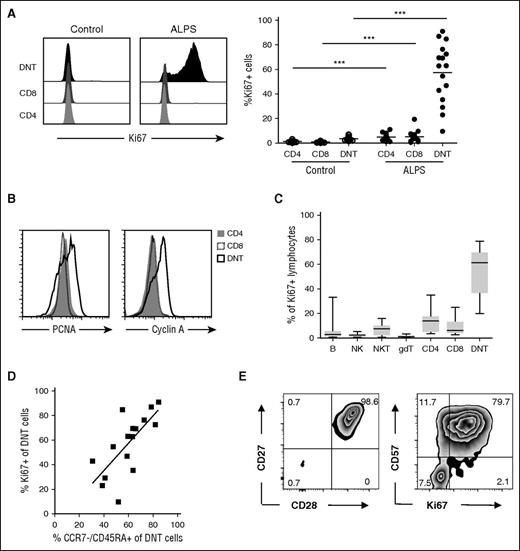 Figure 1. Abnormally differentiated ALPS DNT cells show high proliferative activity in vivo. (A) PBMC from patients with ALPS and healthy controls were gated for CD4+, CD8+, and DNT cells and analyzed for Ki67 expression. Histograms show a representative experiment, y-axis is normalized to mode. Cumulative data of all untreated patients with ALPS and healthy controls are graphed; each symbol represents an individual subject. ***P < .001 (Mann-Whitney U test). (B) Expression of proliferating cell nuclear antigen and cyclin A was determined in ALPS CD4+ (gray, filled), CD8+ (black, dotted), and DNT (black, solid) cells. Overlays show representative data from 1 of 5 independent experiments with similar results. (C) PBMC of patients with ALPS (n = 12) were gated for Ki67+ lymphocytes. Frequencies of B cells (CD3−/CD19+), NK cells (CD3−/CD56+), NKT cells (CD3+/CD56+ or TCRVα24−Jα18+), γδ T cells (CD3+/TCRγδ+), CD4+ T cells (CD3+/TCRαβ+/CD4+), CD8+ T cells (CD3+/TCRαβ+/CD8+), and DNT cells (CD3+/TCRαβ+/CD4−/CD8−) among all Ki67+ lymphocytes were determined by flow cytometry. Box plots depict the 75th percentile, median, and 25th percentile values; whiskers represent maximum and minimum values. (D) Correlation of percentage of Ki67+ DNT cells and frequency of CCR7−/CD45RA+ DN T cells among all ALPS DNT cells is shown; r = .7471; ***P < .001 (Spearman’s test). (E) Expression of CD27, CD28, CD57, and Ki67 were determined in ALPS DNT cells. Plots show representative data from 1 of 3 independent experiments with similar results.