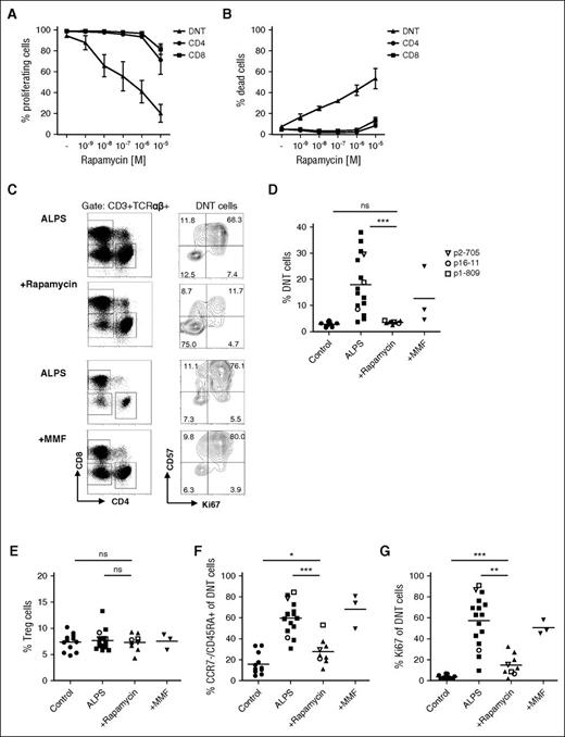 Figure 4. mTOR inhibition reduces abnormally differentiated DNT cells. (A, B) CFSE-labeled ALPS CD4+ (circle), CD8+ (square), and DNT (triangle) cells were stimulated with anti-CD3/CD28 coated beads and IL-2 in the presence of 1 nM, 10 nM, 100 nM, 1 µM, and 10 µM rapamycin. Proliferation (A) and viability (B) were determined by flow cytometry. Data show mean of 3 independent experiments. (C) PBMC from patients with ALPS before and under rapamycin or MMF therapy were gated for CD3+/TCRαβ+ (%DNT cells) or CD3+/TCRαβ+/CD4−/CD8− (DNT cells). (D) Frequency of DNT cells among all T cells in healthy controls (circle), patients with ALPS (square), and patients with ALPS treated with rapamycin (up-pointing triangle) or MMF (down-pointing triangle) is shown. (E) Percentages of CD4+/CD25+/FoxP3+ Treg cells were determined in PBMC from healthy controls and untreated, rapamycin-treated, and MMF-treated patients with ALPS. (F, G) Percentages of CCR7−/CD45RA+ (F) and Ki67+ (G) cells among DNT cells of all studied healthy controls (n = 12) and untreated (n = 16), rapamycin-treated (n = 9), and MMF-treated (n = 3) patients with ALPS is graphed. Each symbol represents an individual subject; open symbols indicate patients with ALPS (p2-705, p16-11, p1-809) before and under therapy. ns, not significant; *P < .05; **P < .01; ***P < .001 (Mann-Whitney U test).