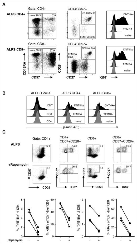 Figure 6. ALPS “DNT-like” CD4+and CD8+ T cells show enhanced mitotic activity and mTOR signaling. CD4+ and CD8+ T cells of ALPS patients were gated for naive (CD45RA+/CD57−), TEMRA (CD57+/CD28−/CD27−), and “DNT-like” (CD57+/CD28+/CD27+) cells and analyzed for their Ki67 expression (A) or phosphorylation status after stimulation with anti-CD3/CD28 mAbs (B). Plots show representative data from 1 of 3 independent experiments with similar results. Y-axis in the histograms is normalized to mode. (C) PBMC from patients with ALPS before and under rapamycin therapy were stained with anti-CD3, anti-CD4, anti-CD8, anti-CD28, anti-CD57, and anti-Ki67 mAbs. Cells are gated for CD3+/CD4+ and CD3+/CD4+/CD57+ (left) or CD3+/CD8+ and CD3+/CD8+/CD57+/CD28− (right). Representative plots show data of a patient with ALPS before and during rapamycin therapy; graphs present frequencies of 3 patients.