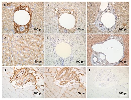 Figure 3. Histology of extravascular FIX distribution. Antibodies to FIX (A,D), Collagen IV (B), FX (C), and FVII (F) were used to stain human liver sections with 3,3′-diaminobenzidine. (E) No primary antibody; all no primary antibody controls lacked background noise. Notice that collagen IV in the sinusoids (B) is not stained with FIX, but that collagen IV and FIX staining generally coincide. The tissues stained with antibodies to FX and FVII differ noticeably from those stained for FIX. (G) A cluster of arteries sectioned in the human skeletal muscle stained for FIX. (H) An adjacent section stained for collagen IV. (I) No primary antibody control. Staining was visualized using a Vectastain ABC Elite Kit (Vector Labs PK-6100), followed by 3,3′-diaminobenzidine. The images were captured with a Nikon Optiphot-2 with a plan-apo lenses and an Olympus DP-70 camera.