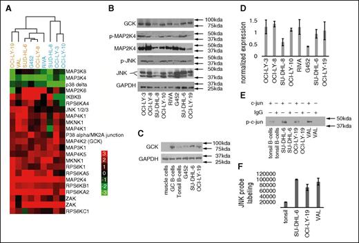 Figure 1. The MAPK family of proteins is upregulated in DLBCL cell lines. (A) An unsupervised heat map comprising the MAPK pathway proteins exhibiting up- or downregulation in 9 DLBCL cell lines, when compared with normal B cells from reactive tonsils. The displayed matrix represents the log2 ratio of LC-MS/MS detected activity/expression of the kinases from each experimental DLBCL cell line relative to normal B lymphocytes, as depicted by the corresponding color scale. Each row represents a separate probe binding site for the indicated kinase, identified and quantified by LC-MS/MS, and each column represents a separate DLBCL cellular lysate. KiNativ data were clustered with Cluster software and visualized with Treeview.15 ABC-like DLBCLs are depicted in blue, and GCB-like DLBCLs are depicted in orange. Similar results were obtained in one additional KiNativ experiment. (B) Immunoblotting of GCK, p-MAP2K4, MAP2K4, p-JNK, and JNK total proteins in unmanipulated DLBCL cell lines. Similar results were obtained in 3 sets of independent blots. (C) Immunoblotting of GCK total protein in muscle cells, human germinal center (GC) B cells, tonsillar B cells, and unmanipulated DLBCL cell lines. Similar results were obtained in 3 sets of independent blots. (D) Normalized expression reflecting average densitometry readings of 3 independent experiments in which total GCK protein levels were quantified and normalized to GAPDH (glyceraldehyde-3-phosphate dehydrogenase) level for protein concentration. Quantification was performed using Image J software (NIH). (E) JNK kinase assay. JNK was immunoprecipitated from the indicated cell lines and tonsils and used to phosphorylate its target c-jun in the presence of ATP. p-c-jun is detected by immunobloting. (F) LC-MS/MS signal for JNK after pull-down with the KiNativ ATP-mimetic probe in B cells purified from human tonsils, and in DLBCL cell lines. KiNativ data (A) is representative of 2 independent experiments. Results in (B-C,E-F) are representative of 3 independent experiments. Results in (D) are the normalized average ± standard error of the mean of 3 independent experiments.