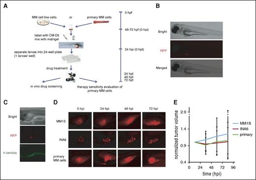 Figure 1. Casper zebrafish support MM cell growth. (A) Schematic chart depicting the procedures used to establish the zebrafish MM xenograft model (hpf, hours postfertilization; hpi, hours postinjection; hpt, hours posttreatment). (B) Fluorescence microscopy images of the CM-Dil–stained MM cells injected into the perivitelline area of Casper zebrafish larvae. Bright field of whole Casper zebrafish 24 hours after injection with human MM cells (top). Red fluorescence protein (RFP) channel of whole Casper zebrafish; the red fluorescence color under the microscope shows CM-Dil–stained MM cells (middle). Merged image from bright field and RFP field (bottom). All cells are located in the perivitelline area after mixing with Matrigel. (C) Whole-mount immunohistochemistry staining. Bright field of whole zebrafish 24 hpi with human multiple MM cells (top). RFP field shows red fluorescence from CM-Dil–stained MM cells (middle). GFP field showing the EGFP-labeled anti–human λ light-chain antibody colocalizing with CM-Dil–labeled MM1S cells (bottom). (D) Typical fluorescence microscopy images of the CM-Dil–stained MM cells xenograft growth of MM1S, INA-6, and primary patient MM cells without drug treatment in the perivitelline area of Casper zebrafish larvae at 24, 48, and 72 hpi. (E) Tumor growth curves of xenografts with these 3 cell types in Casper zebrafish larvae (n = 30 for each group).