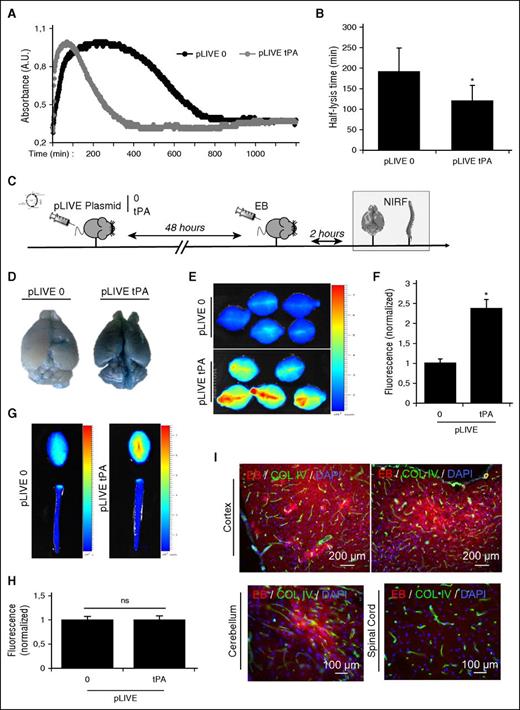 Figure 2. Hyperfibrinolytic state induces BBB leakage of EB. (A) Representative euglobulin lysis time assay from plasma samples of pLIVE-0- and pLIVE-tPA-transfected mice (harvested 48 hours after hydrodynamic transfection). (B) Corresponding quantification of the half-lysis time (n = 5 per group). (C) Experimental design performed to study BBB permeability using NIRF techniques. EB extravasation was measured ex vivo 48 hours after pLIVE (0 or tPA) transfection in the brain and the spinal cord. (D) Representative pictures of ex vivo brains after pLIVE (0 or tPA) transfection. (E) Brain EB permeability was quantified by NIRF. (F) Normalized mean fluorescence quantification of D (n = 5 per group). (G) Ex vivo representative images of the brain and spinal cords after pLIVE transfection. (H) Normalized mean fluorescence quantification of spinal cord EB extravasation (n = 5 per group). (I) Representative epifluorescence images of pLIVE-tPA-transfected animals, showing EB extravasation (red) in the cortex and the cerebellum, but not in the spinal cord. *P < .05 vs control; ns = nonsignificant differences.