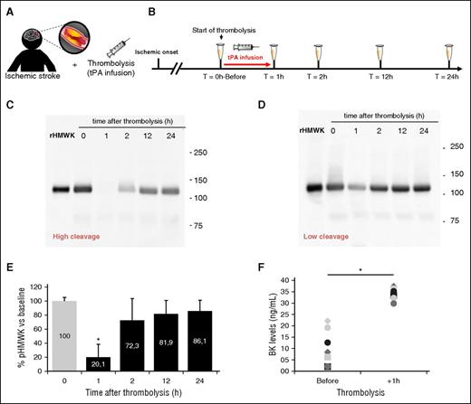 Figure 7. Acute intravenous tPA promotes bradykinin generation in patients with ischemic stroke. (A-B) Time-course of plasma samples collection in patients with ischemic stroke who received thrombolytic therapy. Blood samples were obtained at 0 (before), 1, 2, 12, and 24 hours after tPA infusion. (C-D) Representative western blots of plasmatic HMWK levels (120 KDa) in patients with stroke before and after tPA infusion, showing that plasmin generation promotes HMWK cleavage. Both high (B) and low (C) profiles of HMWK cleavage were found in the small cohort of patients with stroke. Recombinant HMWK was used as a reference. (E) Mean percentage of plasmatic HMWK levels in patients with stroke over time. Baseline levels were used to normalize samples (100%) (n = 8). (F) Quantification of bradykinin (BK) levels in those patients at the baseline level (before) and at the end of thrombolysis (+1 hour), showing that HMWK cleavage promotes bradykinin generation. *P < .05 vs control.