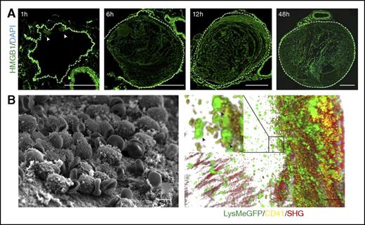 Figure 1. Presence of HMGB1 in the developing venous thrombus. (A) Immunofluorescence staining of cross sections of the IVC for HMGB1 (green) and DAPI (blue) 1, 6, 12, and 48 hours after flow reduction. Arrowheads show HMGB1 deposition, dotted line indicates endothelium; bar, 200 µm. (B) Left, Scanning electron microscopy of the IVC 6 hours after flow reduction, showing the intact endothelium covered by cell aggregates and fibrin; bar, 5 µm. Right, Three-dimensional reconstruction of images from intravital 2-photon microscopy showing the vessel wall (second harmonic generation, red), with adherent platelets (yellow) and neutrophils (green); bar, 50 µm. Box, Platelet-myeloid leukocyte aggregates indicated by arrowheads at higher magnification. (A-B) Images representative of n = 3 experiments.