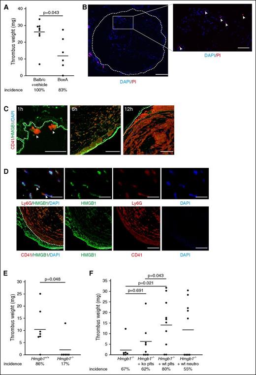 Figure 2. Blood-derived HMGB1 causes venous thrombosis. (A) Thrombus weight in Balb/c mice treated with PBS (n = 8) compared with BoxA (n = 6). (B) Left, Immunofluorescence staining of cross-sections of the IVC for propidium iodide (PI) (red) and DAPI (blue) 6 hours after flow reduction. Dotted line indicates endothelium; bar, 200 µm. Right, Higher magnification of intraluminal propidium iodide–positive cells (arrowheads); bar, 70 µm. (C) Immunofluorescence staining of cross-sections of the IVC 1, 6, and 12 hours after flow reduction for CD41 (red) and HMGB1 (green). Nuclei are counterstained with DAPI (blue). Dotted line indicates endothelium; bar, 100 µm. Images representative of n = 3 experiments. (D) Immunofluorescence staining of cross-sections of the IVC 48 hours after flow reduction. Top, Presence of HMGB1 on NETs (arrowheads) as shown by staining for HMGB1 (green), Ly6G (red), and DAPI (blue); bar, 20 µm. Bottom, HMGB1 (green) colocalizes with platelets (red). Dotted line indicates endothelium; bar, 100 µm. Nuclei are counterstained with DAPI (blue). Images representative of n = 3 experiments. (E) Thrombus weight in Hmgb1+/+ fetal liver cell chimeras (n = 7) compared with Hmgb1−/− chimeras (n = 6). (F) Thrombus weight in Hmgb1−/− bone marrow chimeras (n = 6) compared with Hmgb1−/− chimeras receiving wild-type platelets (n = 10), Hmgb1−/− platelets (n = 8), or wild-type neutrophils (n = 9). (A,E,F) Line indicates mean. The Student t test was used to compare results between 2 groups, 1-way ANOVA followed by LSD–post hoc test for 3 groups.