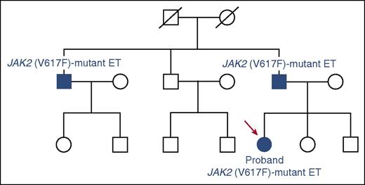 Figure 2. Familial ET. In this family, JAK2 (V617F) was a somatically acquired mutation found in circulating granulocytes (with variable values for mutant allele burden in the different patients) but not in circulating T lymphocytes. Familial ET must be distinguished from hereditary thrombocytosis, a Mendelian genetic disease attributable to germ line mutations of JAK2, MPL, or THPO.