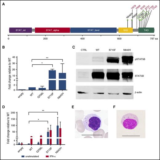 Figure 1. STAT5B mutation characterization. (A) Linear representation of the STAT5B protein structure. Previously known LGL leukemia mutations in STAT5B are marked in the SH2 domain, whereas the novel Q706L and S715F mutations in the transactivation domains are marked with green boxes. Multiple tyrosine and serine phosphorylation sites are marked in red. (B) STAT5B reporter assay results. Mutated STAT5B constructs (pCMV6-XL6 STAT5B) were generated through site-directed mutagenesis followed by transfection and expression of WT and mutated STAT5B (Q706L, S715F, N642H) in HeLa cells together with a STAT5B reporter. Dual-reporter luciferase assay was used to determine activation and phosphorylation of mutated STAT5B. The experiment was repeated 3 times. Columns represent mean of the fold-change activity. Error bars indicate the standard error of the mean (SEM), and the statistical significance was calculated with a 1-way analysis of variance (ANOVA; *P < .05, **P < .001). (C) To investigate the phosphorylation status of the variants, HeLa cells transfected with the abovementioned variants were analyzed by western blot with a phosphoSTAT5 (Tyr694) specific antibody. Protein lysates of the different variants were separated on an sodium dodecyl sulfate-polyacrylamide gel electrophoresis gel and transferred to a nitrocellulose membrane. STAT5 protein levels of the different variants were used to normalize for the transfection efficacy. β-Actin was used as a loading control. (D) Transfected HeLa cells were stimulated with 100 ng/mL interferon-α for 6 hours. A dual-reporter luciferase assay was used to determine activation and phosphorylation of mutated STAT5B. The experiment was repeated 2 times. Columns represent mean of the fold-change activity. Error bars indicate the SEM, and the statistical significance was calculated with a 1-way ANOVA (*P < .05, **P < .001). (E) Typical morphology of a representative LGL cell in a STAT5B mutated T-LGL patient. Scale bar, 15 μm. (F) Morphology of lymphocyte expressing CD4, CD56, and TCRαβ in a healthy individual. CD4+CD56+ and TCRαβ-type lymphocytes were sorted by the FACS method and stained with Wright-Giemsa stain. A representative cell is shown. Scale bar, 15 μm.