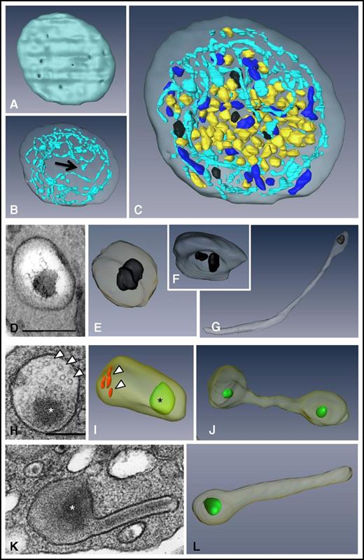 Figure 1. 3D ultrastructure of unstimulated platelets using FIB-SEM. (A-C) 3D representations of a human platelet showing (A) the openings of the OCS at the platelet surface (gray), (B) the spatial arrangement of the OCS (blue) and of the closed canalicular system (arrow), and (C) the distribution of α granules (yellow), δ granules (black), and mitochondria (dark blue) in the whole platelet (see supplemental Movie 1 for an animation). (D-G) Images from TEM thin sections and (E-G) 3D FIB-SEM reconstructions of δ granules. These granules are mostly spherical, contain 1 or 2 characteristic electron-dense substructures, and may display a tail extension. (H-L) Images from TEM thin sections and 3D FIB-SEM reconstructions of α granules. (I) Oval α granules contain a nucleoid (*) shown in green and VWF (arrowheads) shown in red. Also shown are (J) a haltere and (L) tubular α granules that has developed a long extension. Scale bars, 200 nm.