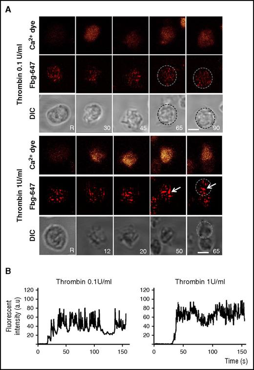Figure 3. Compound fusion of fibrinogen-labeled α granules is induced by 1 U/mL thrombin. Platelets were co-labeled with Oregon Green BAPTA-1 (orange, upper panel) and Alexa 647-conjugated fibrinogen (Fbg-647; red, middle panel). Platelets were washed before stimulation with thrombin (0.1 or 1 U/mL), and platelets were monitored in real time by fluorescence microscopy and differential interference contrast (DIC) microscopy (morphology, lower panel). (A) Representative live images were recorded before stimulation (unstimulated: R) and after stimulation at the indicated times (inset). The platelets were not stirred. Arrows indicate fibrinogen-positive spots that increased in size. Single platelets are surrounded by dotted circles. Scale bar, 2 µm. (B) Representative tracings of the time course of the changes in Oregon Green BAPTA-1 staining in platelets stimulated with 0.1 and 1 U/mL thrombin. The fluorescence is expressed as the normalized fluorescence intensity in arbitrary units (a.u.).