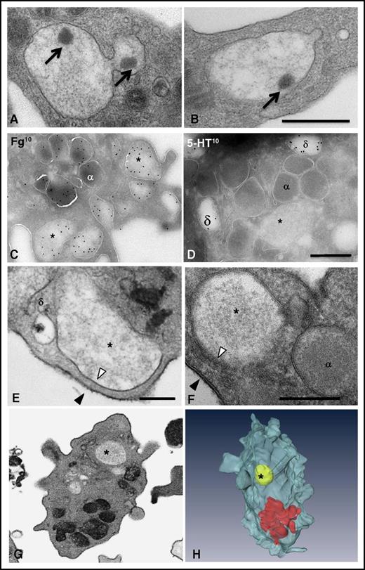 Figure 4. Multigranular compartments result from the homotypic fusion of α granules. (A-B) Ultrastructural TEM analysis of multigranular compartments in platelets stimulated with 1 U/mL thrombin for 10 seconds. Two representative TEM images illustrate the presence of nucleoids (arrows) in the aggregates. (C-D) IEM characterization of the multigranular compartments. Electron micrographs of ultrathin cryosections of platelets stimulated with 0.1 U/mL thrombin. Antibodies were detected with protein A coupled to 10-nm gold particles. (C) Multigranular compartments (*) were identified as fused α granules by immunolabeling with an antifibrinogen antibody. Labeling with antiserotonin was absent from these structures (*), whereas δ granules (δ) were positive. (E-F) Representative TEM images showing that the limiting membrane of the multigranular compartments (*) is not electron-dense (white arrowheads) whereas the plasma membrane is positive for tannic acid (black arrowheads). Note the presence of a δ granule close to the multigranular compartment in (E) without any fusing profile. (G-H) FIB-SEM analysis of the unstained multigranular compartments in platelets stimulated with 1 U/mL thrombin for 10 seconds. An example of the FIB-SEM raw observations and the corresponding 3D reconstruction of stained granules (in red) and an unstained multigranular compartment (in yellow) are shown. Scale bars, 500 nm.