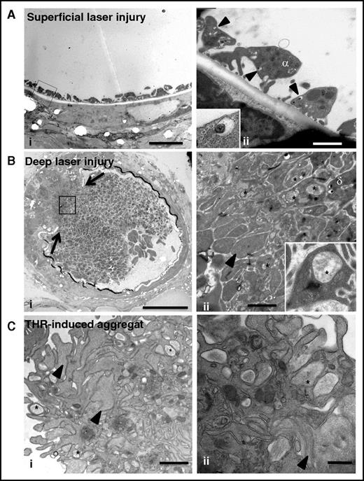 Figure 6. Compound exocytosis occurs in vivo during thrombus formation. (A) (i) TEM analysis of a murine mesenteric artery after superficial laser injury showing adherent platelets at the site of endothelial denudation. Scale bar, 5 µm. (ii) Higher magnification showing that the platelets contain individual granules but no multigranular compartments. Note the presence of δ granules (arrowheads) close to the plasma membrane (insert in ii). Scale bar, 1 µm. (B) (i) TEM analysis of a murine mesenteric artery after deep laser injury showing disruption of the vessel wall (arrows) and a gradient of activation of platelets. Scale bar, 20 µm. (ii) Higher magnification of the box illustrating the presence of fully degranulated platelets devoid of secretory organelles (arrowhead) in the deeper area and granule-containing platelets close to the lumen. Scale bar, 1 µm. Note the presence of multigranular compartments (*) in platelets located at the interface. (Insert in ii) Platelet containing a large intracellular structure (*). (C) Ultrastructure of an in vitro aggregate. Platelets were stimulated with 1 U/mL thrombin and fixed at the time point corresponding to maximal aggregation (3 minutes). (i) TEM analysis revealed a heterogeneous thrombus composed of degranulated platelets (arrowheads) at the periphery and granule-containing platelets in the center. Scale bar, 1 µm. (ii) Multigranular compartments were observed in both areas (*). Scale bar, 500 nm.
