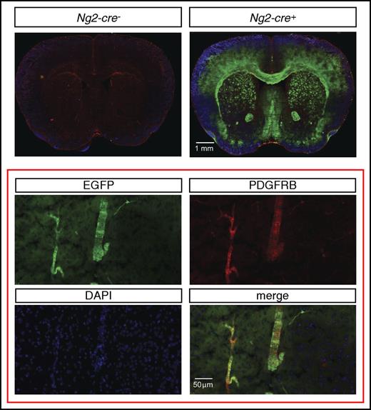 Figure 3. Ng2-cre–mediated recombination in cerebral vascular mural cells. (Top) Representative images of EGFP (green signal) and PDGFRB (red signal) immunofluorescence in brains from control (Ng2-cre-) and NG2-mT/mEGFP mice that were deficient for Phd2 (Ng2-cre+). NG2-mT/mEGFP-Phd2−/− mice are phenotypically normal and did not develop polycythemia. (Bottom) Magnification shows coexpression of PDGFRB (red signal) and EGFP (green signal) in NG2 cells.