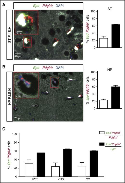 Figure 4. Brain pericytes express Epo mRNA. Shown are the results of multiplex RNA FISH studies for Epo and Pdgfrb transcripts using formalin-fixed, paraffin-embedded brain tissue sections from NG2-Vhl−/− mutant mice. (A) (Left) Representative image of a striatal section (ST) containing pericytes that coexpress Epo (green signal) and Pdgfrb transcripts (red signal). Nuclei are stained with 4',6-diamidino-2-phenylindole (DAPI; blue fluorescence). Bright white structures inside the vessels represent RBCs. (Right) Percentage of Pdgfrb+ cells coexpressing Epo mRNA (white bar) or Epo+ cells coexpressing Pdgfrb transcripts (black bar) (n = 3). (B) (Left) Representative image of a hippocampal section (HP) containing pericytes that coexpress Epo (green signal) and Pdgfrb transcripts (red signal). Nuclei are stained with DAPI (blue signal). (Right) Percentages of Pdgfrb+ cells that coexpress Epo transcripts (white bar) or Epo+ cells that coexpress Pdgfrb transcripts (black bar) (n = 3). (C) Percentages of Pdgfrb+ cells coexpressing Epo transcripts (white bar) or Epo+ cells that coexpress Pdgfrb transcripts (black bar) in hypothalamus (HYT), cortex (CTX), and corpus callosum (CC) (n = 3 each).