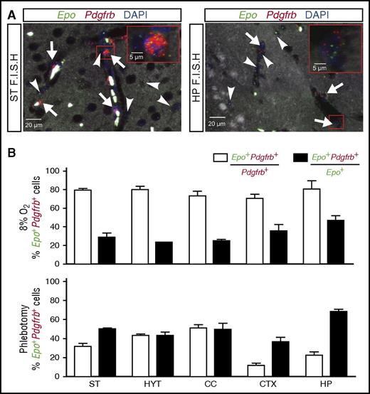 Figure 5. Normobaric hypoxia and anemia stimulate EPO synthesis in brain pericytes. Shown are the results of multiplex RNA FISH studies for Epo and Pdgfrb transcripts using formalin-fixed, paraffin-embedded brain tissue sections from wild-type mice exposed to normobaric hypoxia (8% O2 for 24 hours) or after phlebotomy (average Hct: 20.7%). (A) (Left) Representative image of a striatal section (ST) containing pericytes (white arrows) that coexpress Epo (green signal) and Pdgfrb transcripts (red signal) and nonpericytic Epo+ cells (white arrowhead). Nuclei are stained with DAPI (blue fluorescence). (Right) Representative image of a hippocampal section (HP) containing pericytes (white arrows) that coexpress Epo (green signal) and Pdgfrb transcripts (red signal) and Pdgfrb− Epo+ cells (white arrowhead). Nuclei are stained with DAPI (blue signal). (B) (Upper) Percentages of Pdgfrb+ cells that coexpress Epo (white bar) or Epo+ cells that coexpress Pdgfrb transcripts (black bar) in striatum (ST), hypothalamus (HYT), corpus callosum (CC), cortex (CTX), and hippocampus (HP) from wild-type mice exposed to normobaric hypoxia (8% O2 for 24 hours) (n = 3). (Lower) Percentages of Pdgfrb+ cells that coexpress Epo (white bar) or Epo+ cells that coexpress Pdgfrb transcripts (black bar) in striatum (ST), hypothalamus (HYT), corpus callosum (CC), cortex (CTX), and hippocampus (HP) from phlebotomized wild-type mice (n = 3).