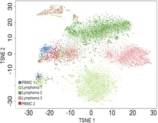Figure 1. Assignment of 13.5K B-cells to normal and malignant phenotypes.
